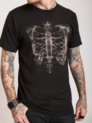 X-Ray T-Shirt