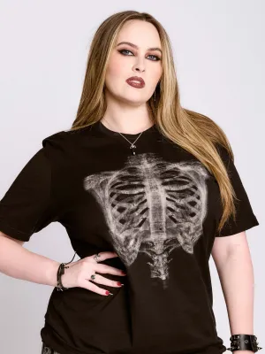 X-Ray T-Shirt